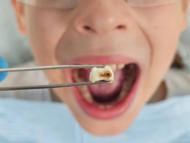 Best Emergency Pediatric Dentist  in USA